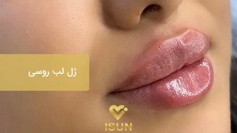 ژل لب روسی